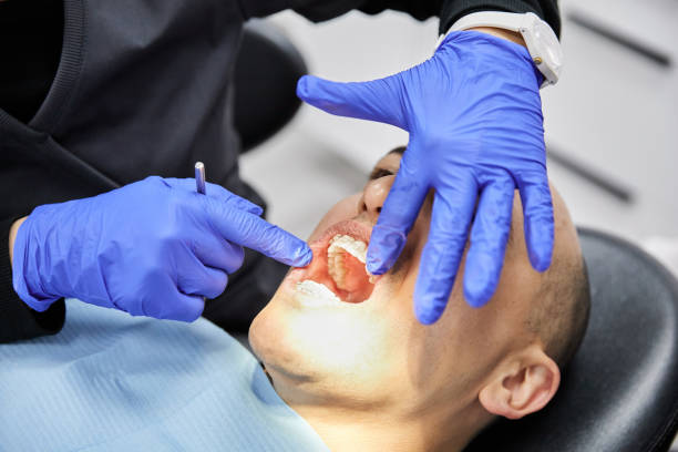 Best Knocked-Out Tooth Emergency  in Mira Monte, CA